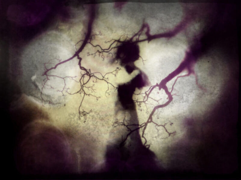 Ramificaciones del deseo